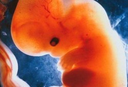 9周胎儿多大（怀孕9周胎儿多大）