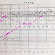 胎心快对胎儿有影响吗（胎心率160到170正常吗）