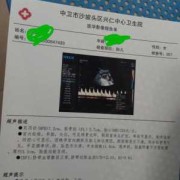 医生说胎儿腿长是暗示（医生说胎儿腿长是暗示男女吗）
