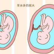羊水少胎儿会畸形吗（羊水少胎儿会畸形吗图片）