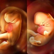 怀孕5周胎儿图片（怀孕5周胎儿图片欣赏）