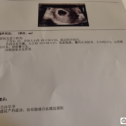 四十天小孩会不会认妈,怀孕40天胎儿有心跳吗正常吗