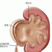胎儿肾盂分离的原因（胎儿左肾集合系统分离是什么意思）