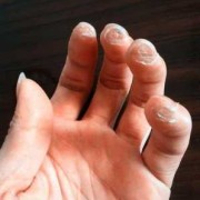 疼是不是二点水偏旁,孕期手疼是怎么回事