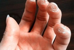 疼是不是二点水偏旁,孕期手疼是怎么回事