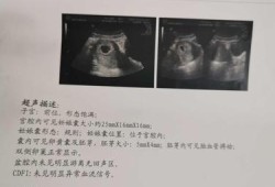 胎儿动时胎心超过160（孕晚期胎心超过160是属于正常的吗）