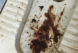 孕期吐苦水（苦水都吐出来了是什么意思）