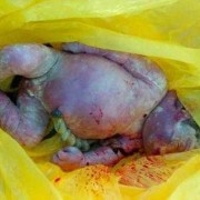 胎儿胎死腹中的原因（胎儿胎死腹中是什么原因）