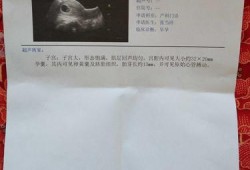 胎儿多久有胎心（胎儿多久有胎心胎芽）