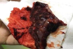 胎儿生化是什么症状（生化妊娠为什么会腹痛的啊？还是很想知道的）