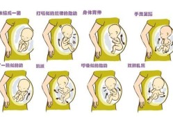 胎儿滑动（胎儿滑动式胎动原因）