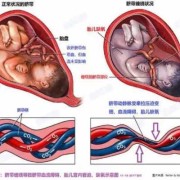 脐带连接胎儿什么器官（脐带连接胎儿什么器官最好）