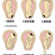 胎儿仰卧位示意图（胎儿仰卧位示意图片）
