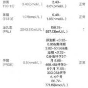 怀孕期间泌乳素正常值（怀孕期间泌乳素正常值是多少）