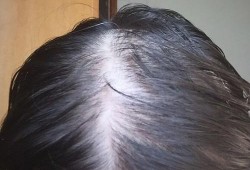 为什么怀孕后，身上毛发生长慢了,孕期头发不掉了怎么回事