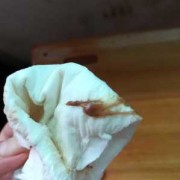 孕妇积液对胎儿影响吗（积液是到底是水还是血）