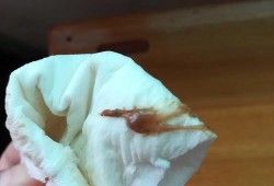 孕妇积液对胎儿影响吗（积液是到底是水还是血）