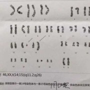 孕期染色体检查是什么（胎儿染色体检查什么）
