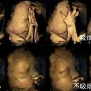 吸烟对胎儿（吸烟对胎儿的影响到底有多大）