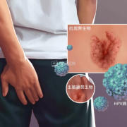尖锐湿疣能要孩子吗,尖湿锐尤会影响胎儿吗
