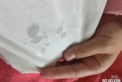 孕期乳头出水（怀孕四个多月了，乳头出水是什么情况）