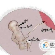 怀孕期间羊水多怎么办（怀孕期间羊水多是什么原因造成的）