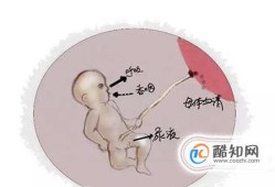 怀孕期间羊水多怎么办（怀孕期间羊水多是什么原因造成的）