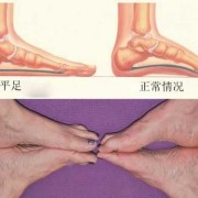 为什么孩子的脚比同龄人的脚偏大了这么多,胎儿手脚畸形的原因有哪些