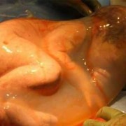 8斤的胎儿（8斤的胎儿顺产还是剖腹产）