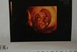 胎儿12周有多大（孕妇怀孕到12周胎心160正常吗）