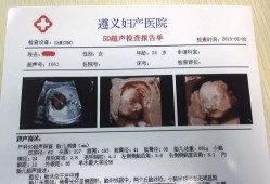 做彩超胎儿不配合咋办（做彩超胎儿不配合怎么办）