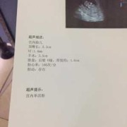 胎儿打嗝就证明没缺氧（胎儿打嗝就证明没缺氧吗）