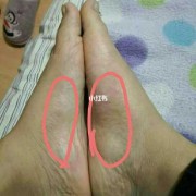 孕期脚热怎么回事（怀孕，脚老是出汗什么原因）