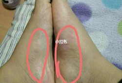 孕期脚热怎么回事（怀孕，脚老是出汗什么原因）