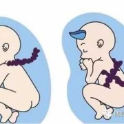 孕妇检查发现胎儿脐带绕颈怎么办,胎儿绕颈w是什么意思