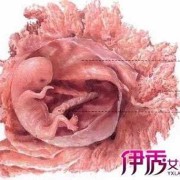 什么情况下胎儿会畸形（畸形胎儿胎动会频繁吗）