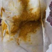 6个月宝宝肚子咕噜响，是怎么回事？宝宝的肚子总是在咕噜咕,6个月的胎儿图片 真实