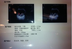 胎儿唇鄂在第几周发育（内高班体检项目有哪些）