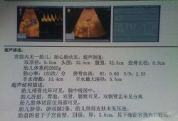 孕36周b超偏小两周该怎么办，医生建议我多吃点东西，但是我真的没胃口啊,36周胎儿偏小两周怎么办.羊水偏少