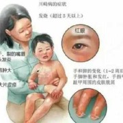 胎儿嘴唇裂（婴儿嘴巴热怎么办呢？是发烧的症状吗）