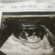 怀孕12周肚子有多大？12周的胎儿有胎动了吗,孕期12周检查什么项目