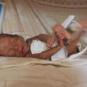 胎儿早产征兆（在怀孕29周的时候出生的早产宝宝，正常的发育标准是多少啊）