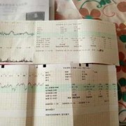 胎儿心率169显示过快，医生说没事,胎心率160到170正常吗