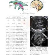 胎儿中央帆腔（胎儿中央帆腔）