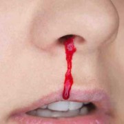 怀孕期间流鼻血是怎么回事（孕妇经常流鼻血是怎么回事）