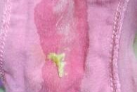 孕期白带稀薄（白带很稀，像水一样是怎么回事啊）