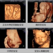 胎儿大排畸和四维的区别（胎儿大排畸和四维的区别是什么）