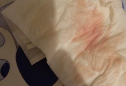 见红会引起胎儿缺氧吗（见红会引起胎儿缺氧吗）