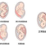 孕期胎盘位置会变吗（孕期胎盘位置会改变吗）