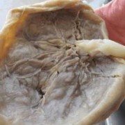 胎盘胎儿面（猪胎盘长什么样）